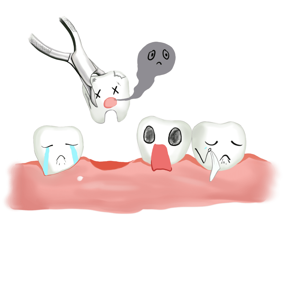 ฟันบนหลุด